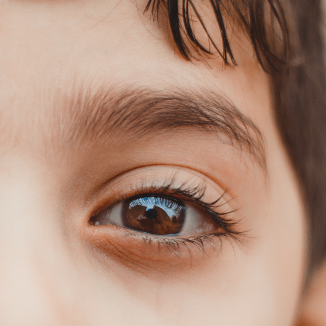 Retinoblastoma.png